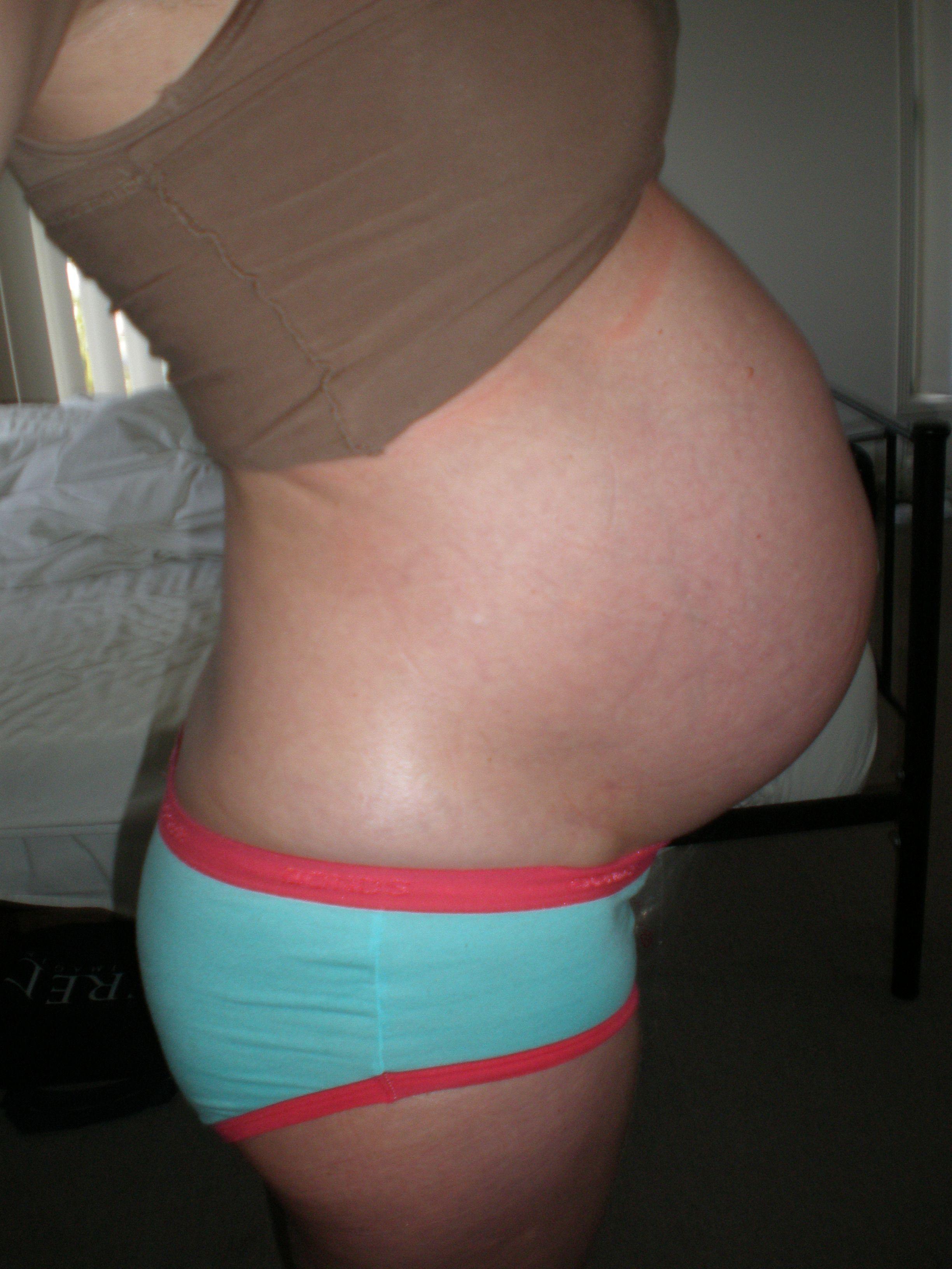 Teens Pregnant Pics